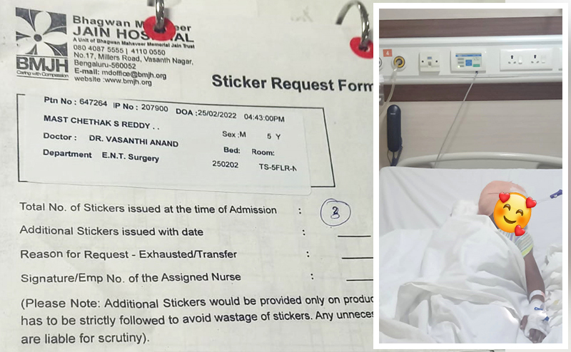 Cochlear Implant Surgery